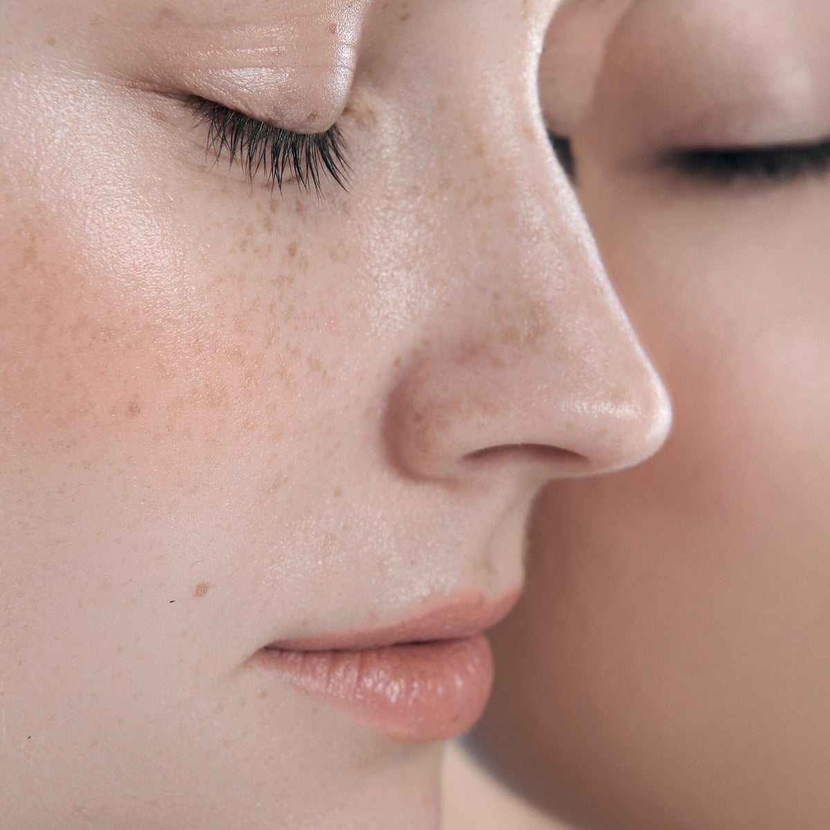 A-Derma Protect Kids, close-up of fair, freckled skin in soft light