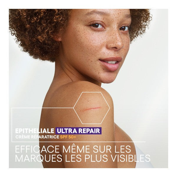 A-Derma Epitheliale, freckled woman looking over her bare shoulder, text in French