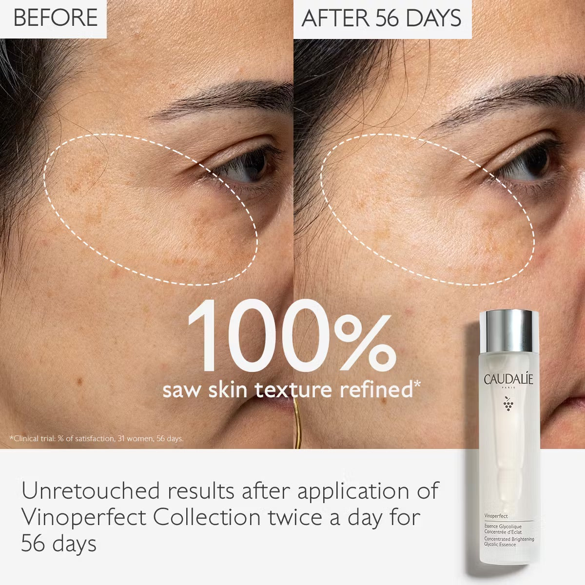 Caudalie Vinoperfect Brightening Glycolic Essence 100ml bottle, product close-up