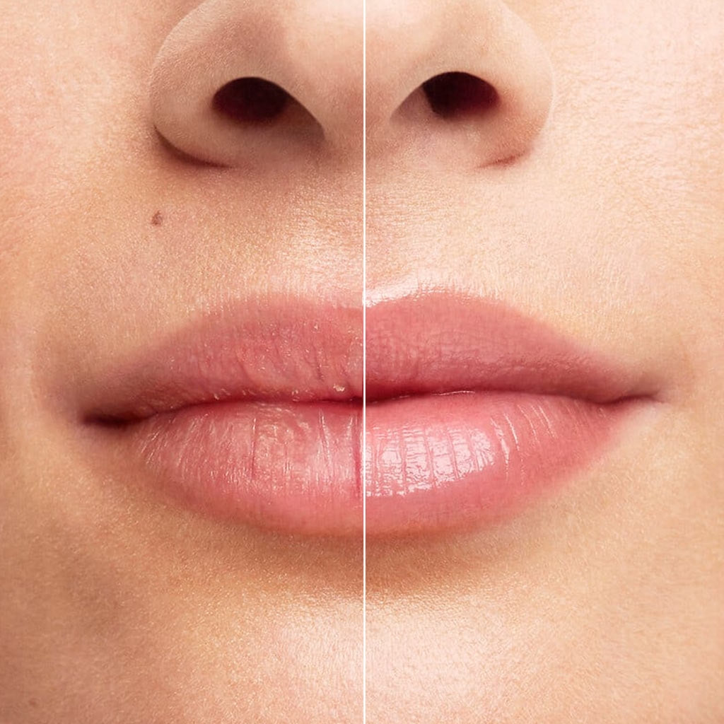 Bioderma Cicabio, split before and after photo of the lips