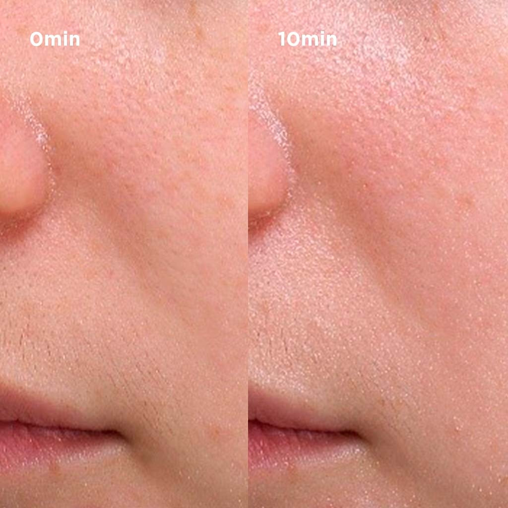 Bioderma Hydrabio, before and after photos of the nose and cheek