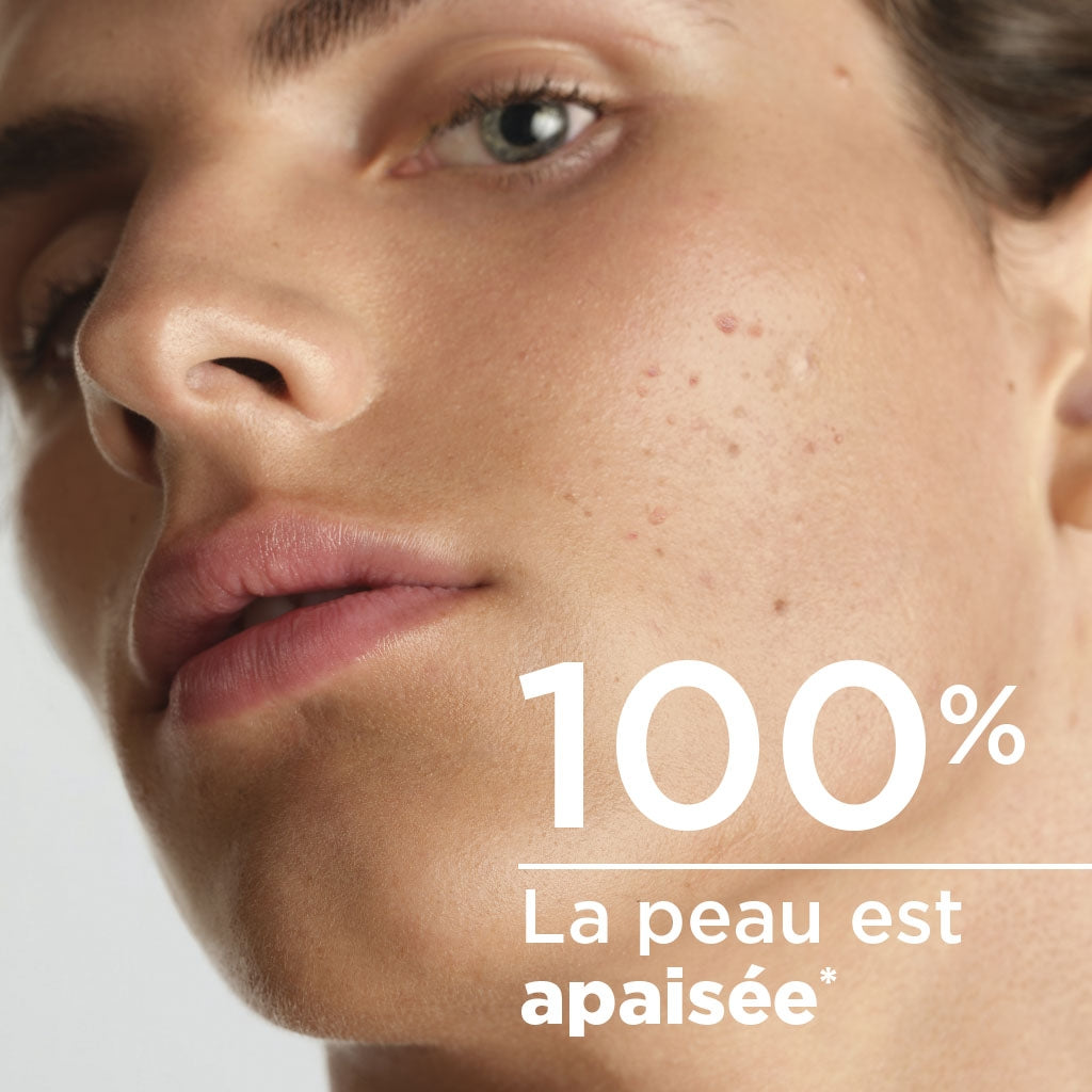 Bioderma Sébium Hydra, close-up of a face in three-quarter view with study results in French