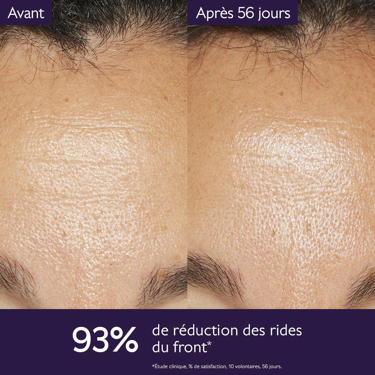 Caudalie Premier Cru, before and after photos of the forehead