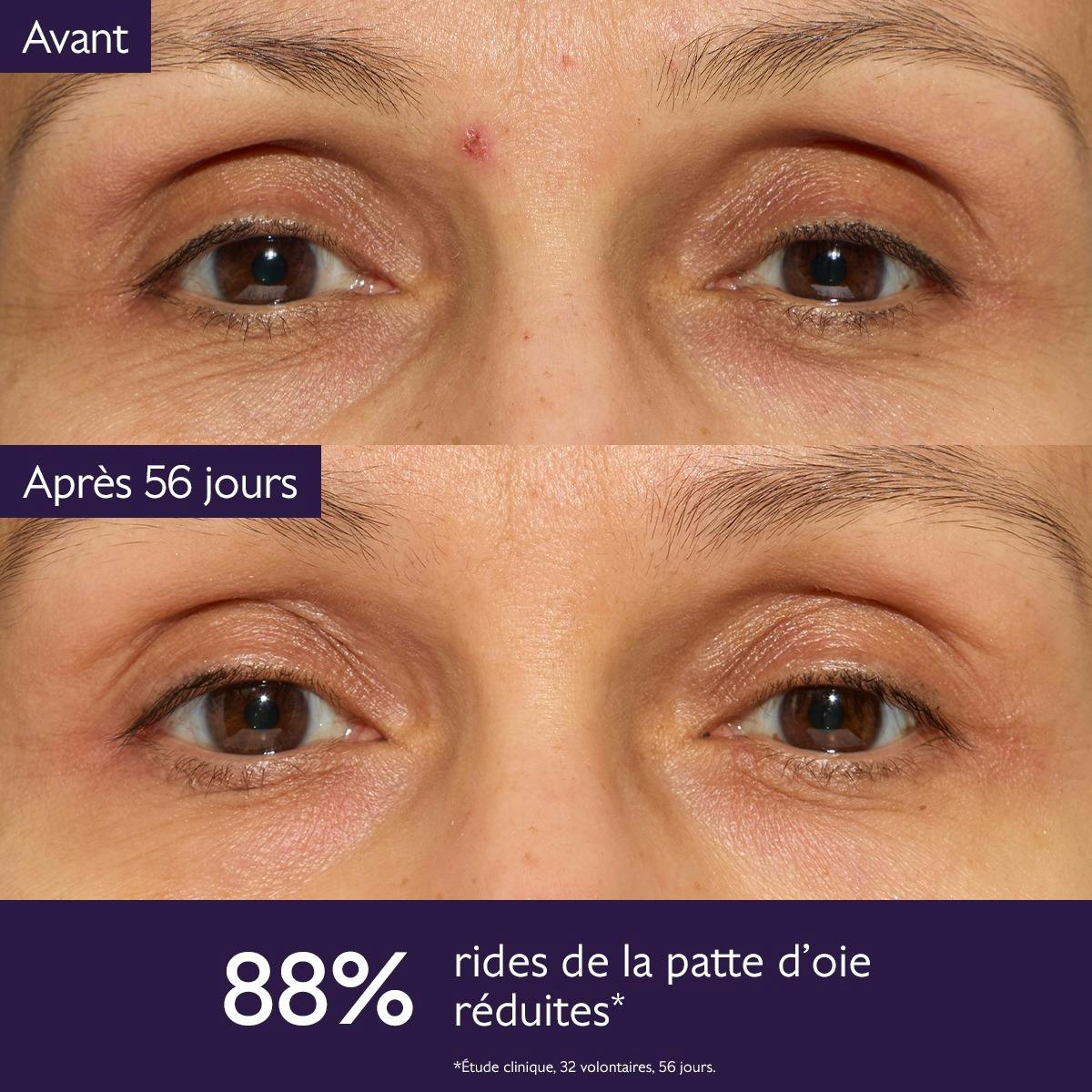 Caudalie Premier Cru, before and after photos of the eye area