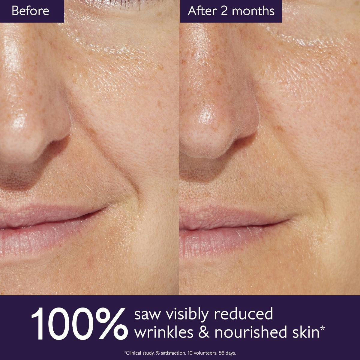 Caudalie Premier Cru, before and after photos of the nose and mouth area