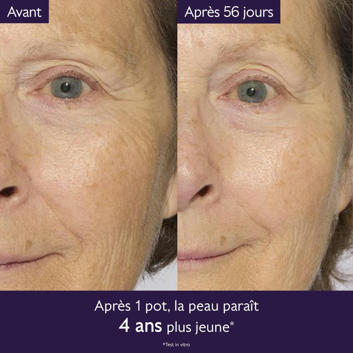 Caudalie Premier Cru, before and after photos of the eye and cheek area