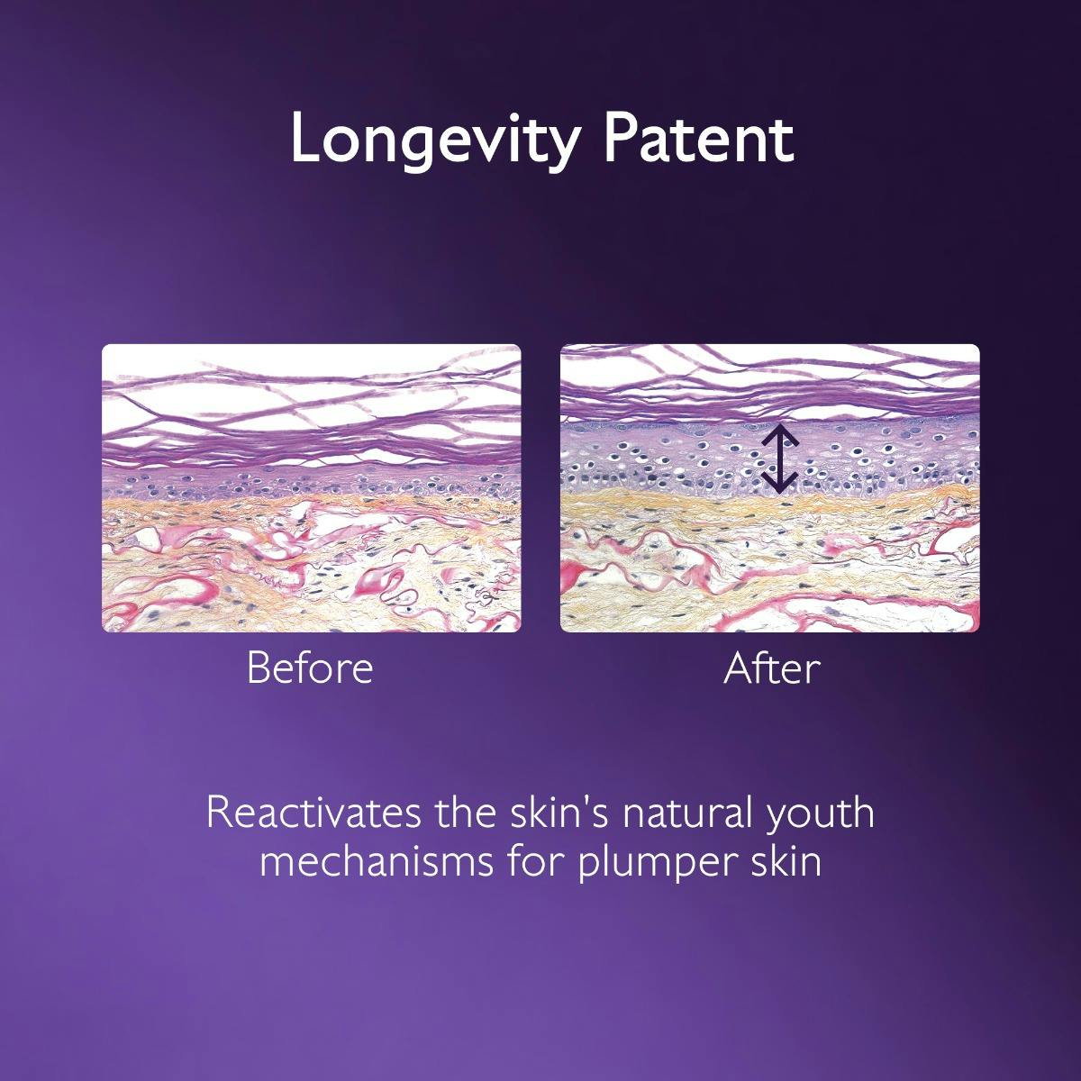 Caudalie Premier Cru, longevity patent infographic with skin cross-sections