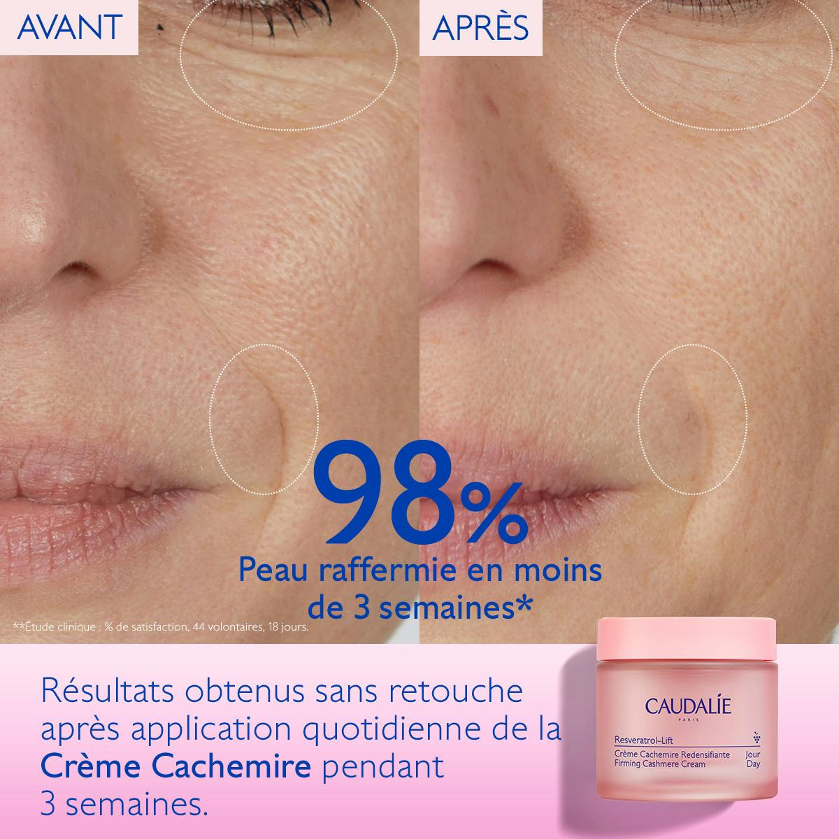 Caudalie Resveratrol-Lift, before and after photos of the cheek and mouth with the jar