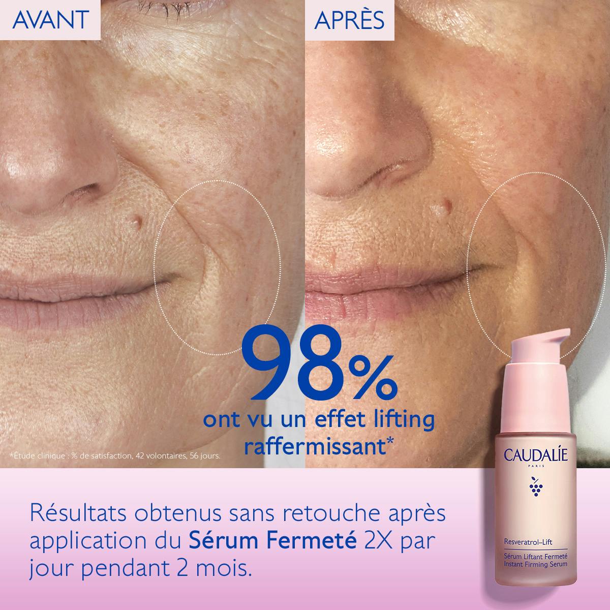 Caudalie Resveratrol-Lift, before and after photos of the cheek with the pump bottle