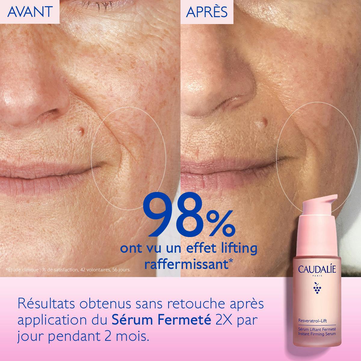 Caudalie Resveratrol-Lift, before and after photos of the lower face, text in French