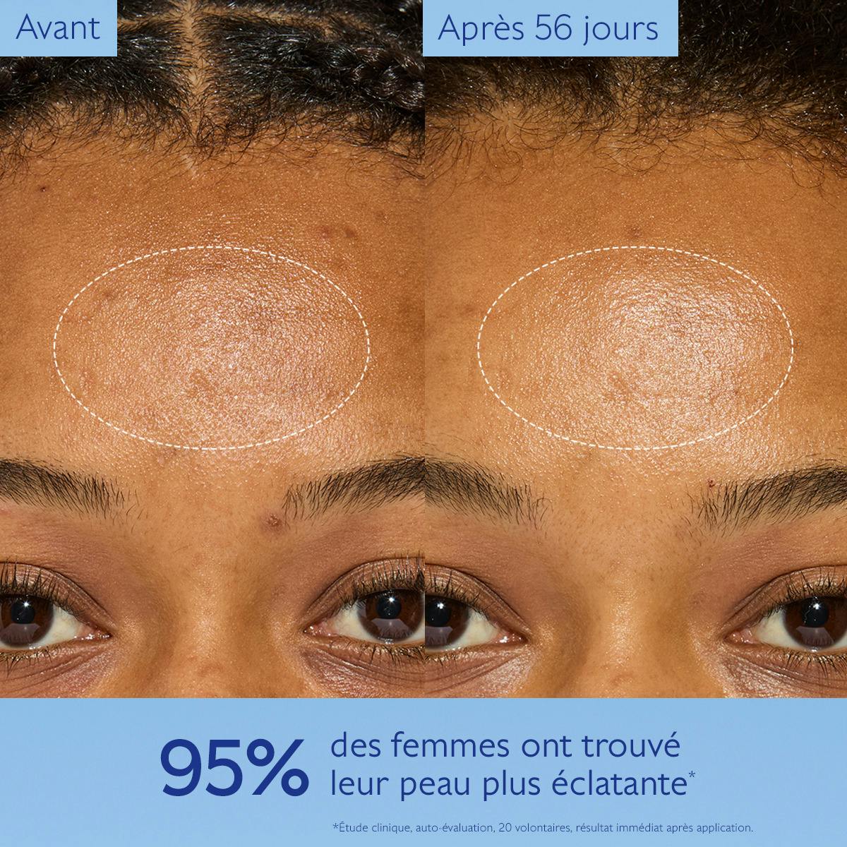 Caudalie Vinoperfect, before and after photos of the forehead