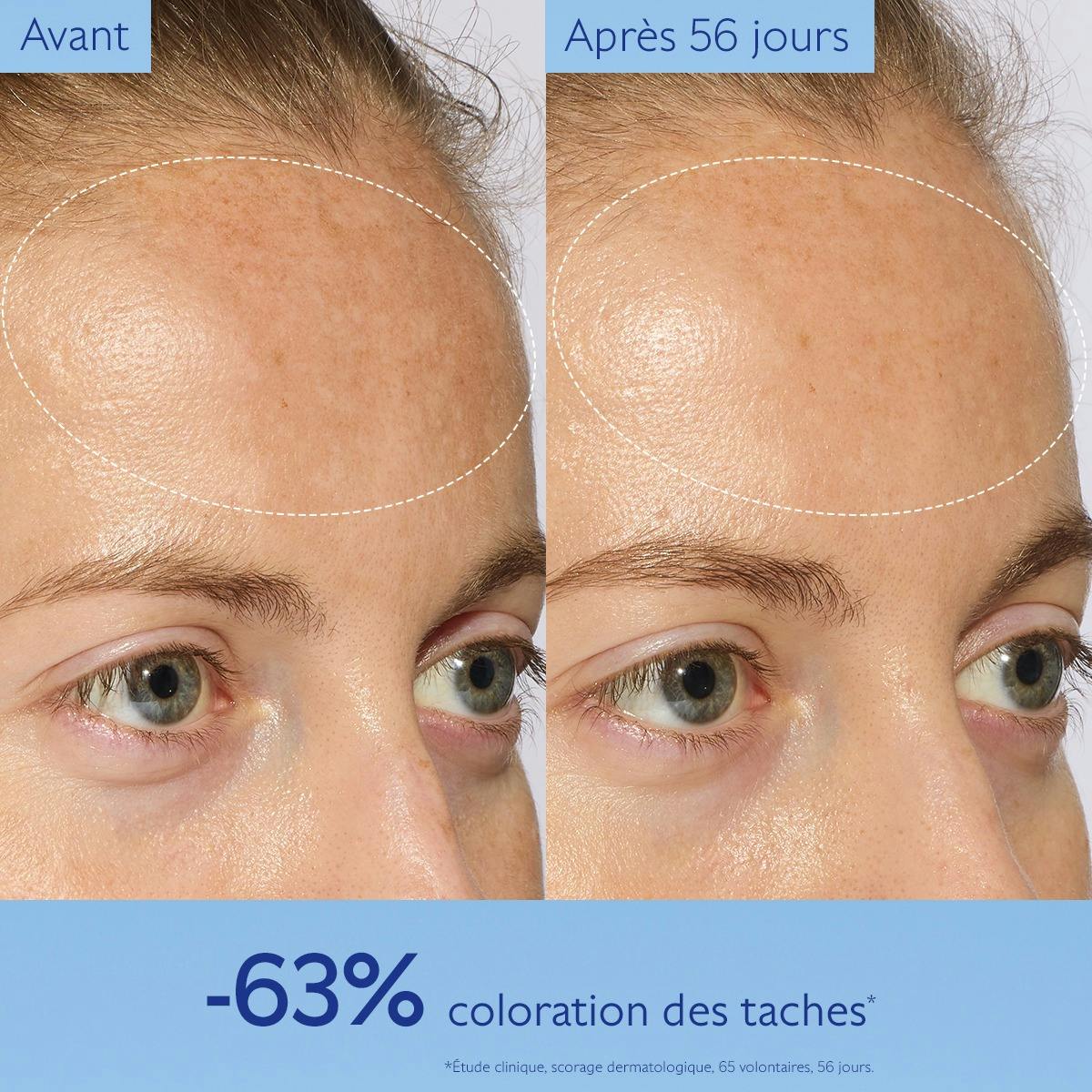 Caudalie Vinoperfect, before and after photos of the forehead