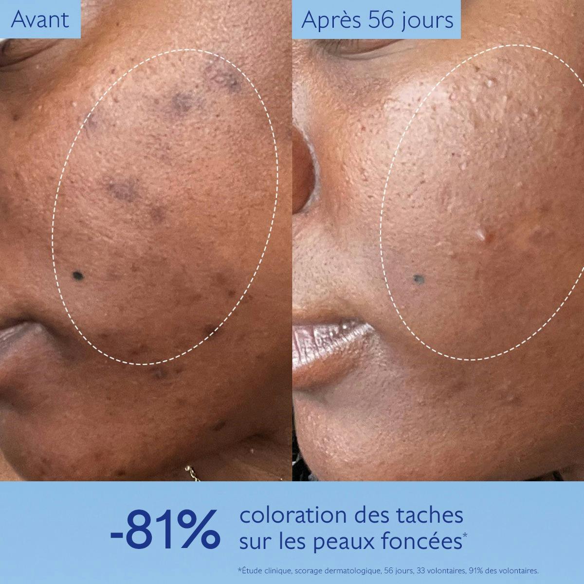 Caudalie Vinoperfect, before and after photos of a cheek on deeper skin
