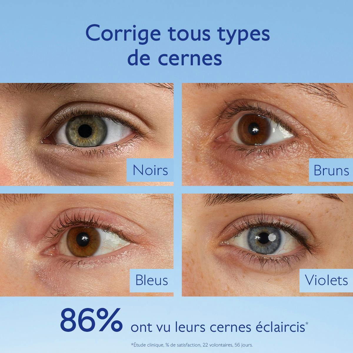 Caudalie Vinoperfect, four eye close-ups showing dark circle types, in French