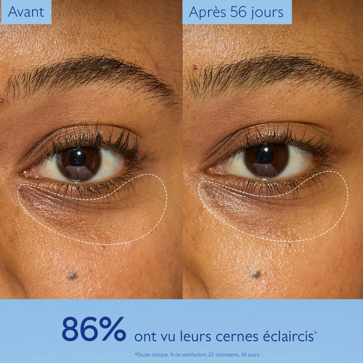 Caudalie Vinoperfect, before and after photos of the under-eye area