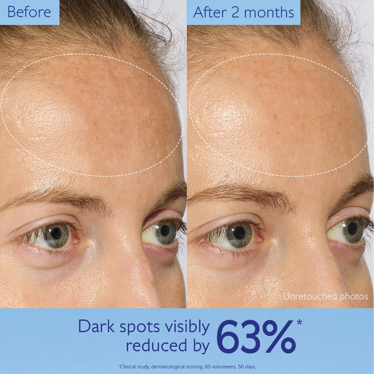 Caudalie Vinoperfect, before and after photos of the forehead