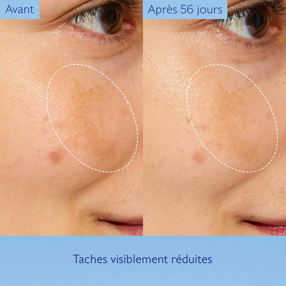Caudalie Vinoperfect, before and after photos of a cheek