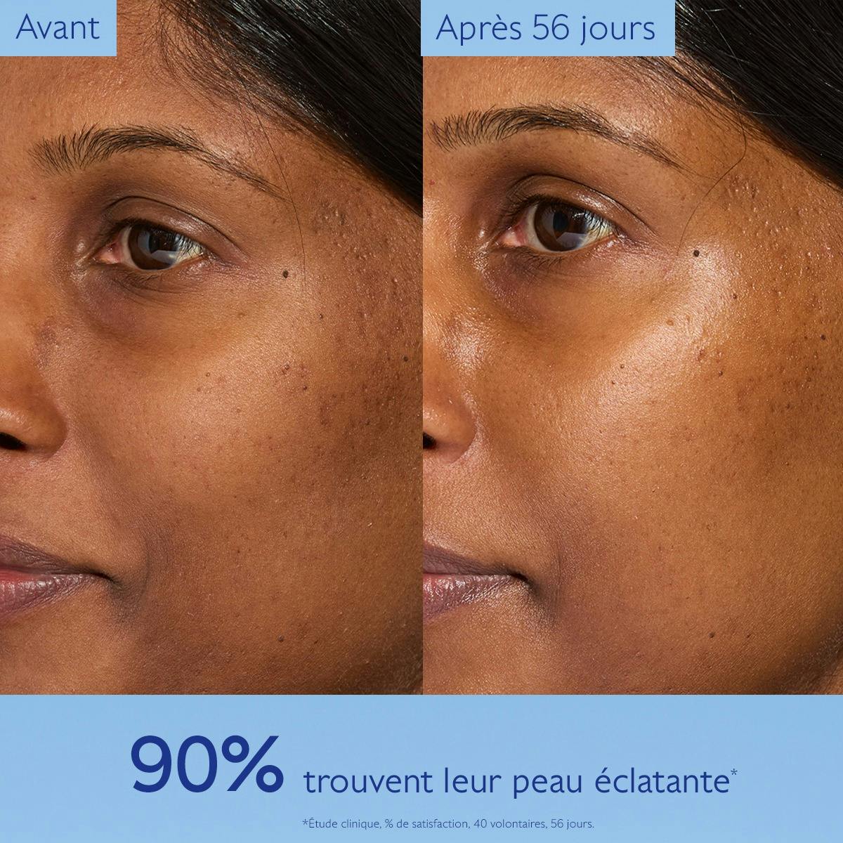 Caudalie Vinoperfect, before and after photos of the cheek