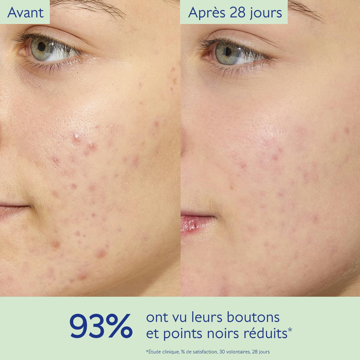Caudalie Vinopure, before and after photos of the cheek