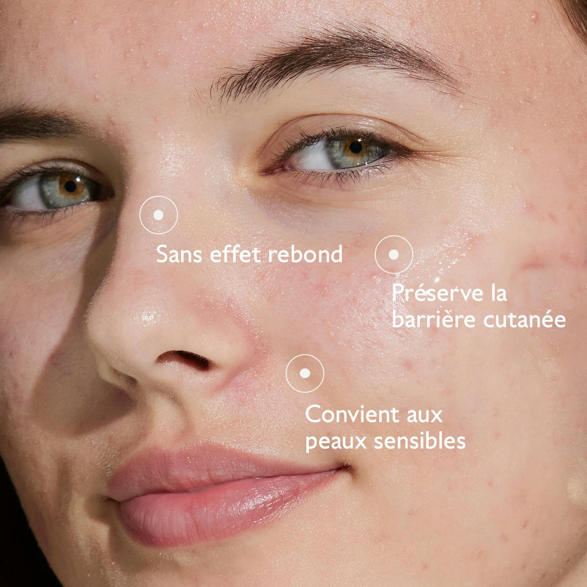 Caudalie Vinopure, close-up of a woman's face with benefits in French