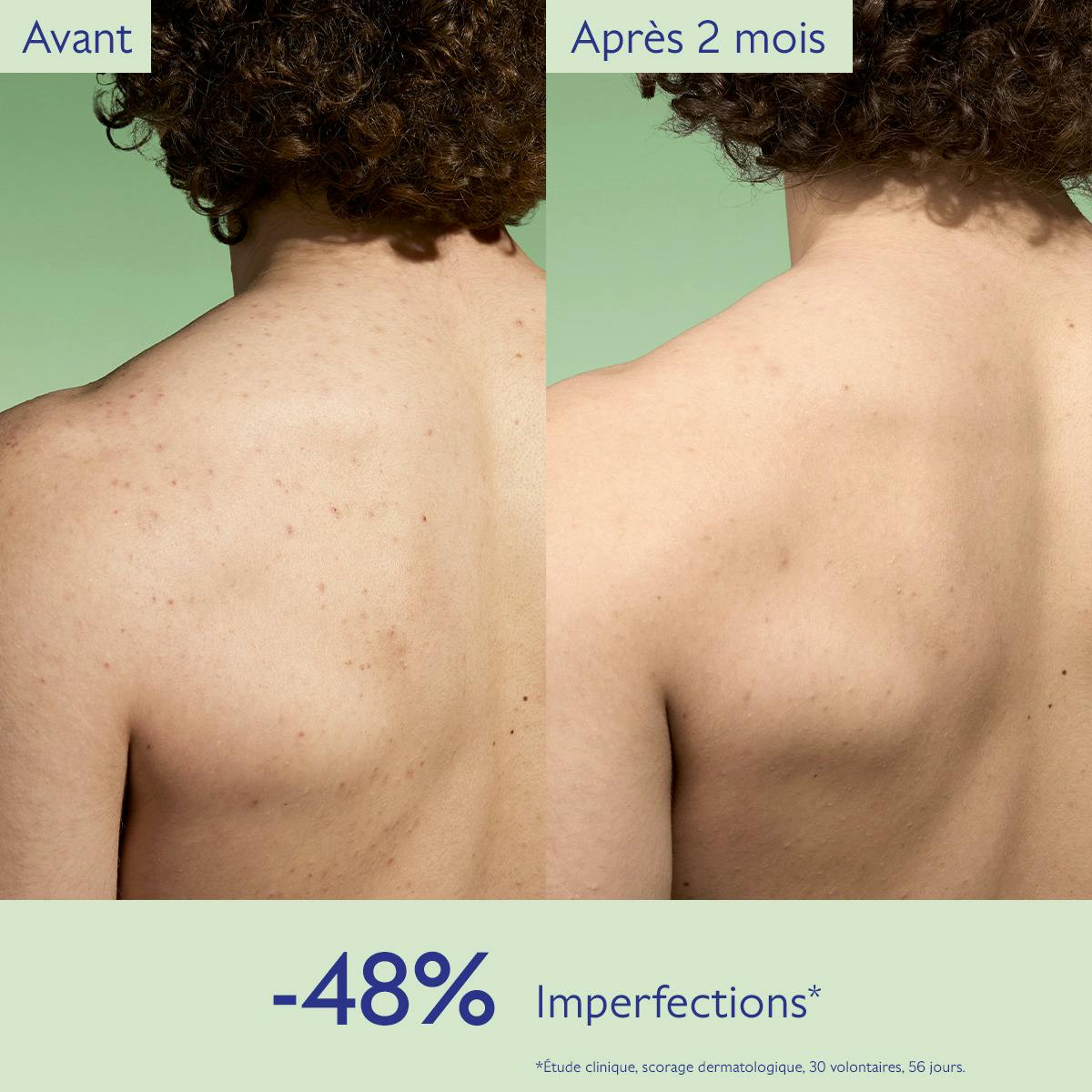 Caudalie Vinopure, before and after photos of the upper back