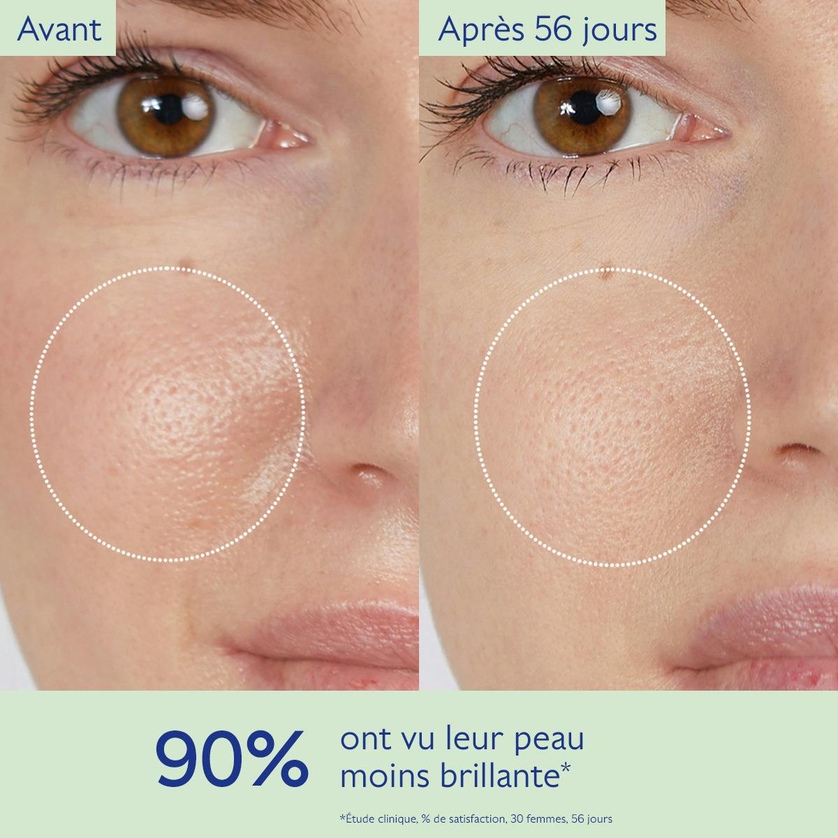 Caudalie Vinopure, before and after photos of the cheek