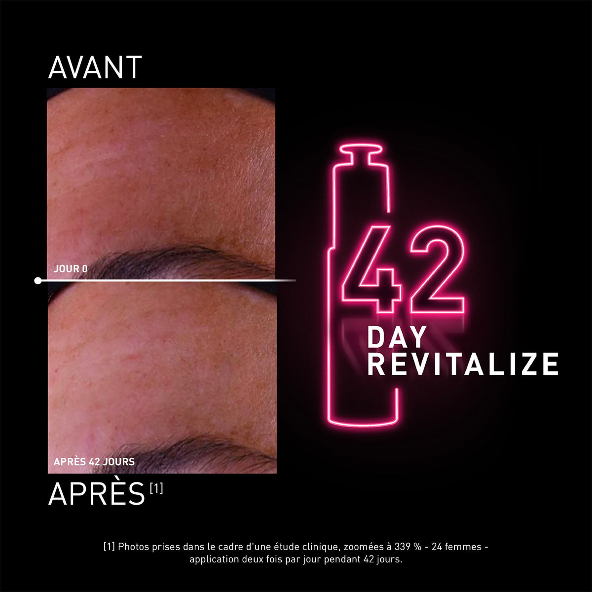 Filorga NCEF-Revitalize, before and after photos of the forehead