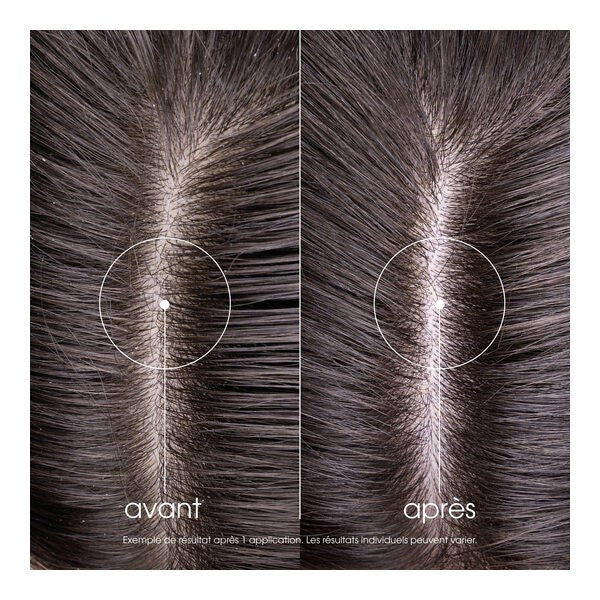 Klorane Citron, before and after photos of a hair parting