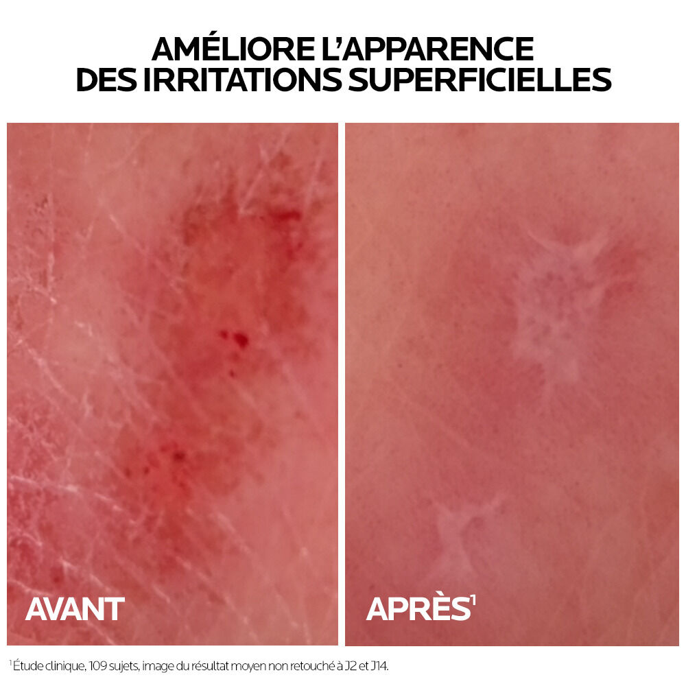 La Roche-Posay Cicaplast, before and after photos of the skin, close-up