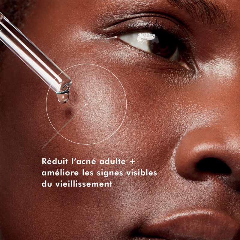 SkinCeuticals Blemish + Age Defense, pipette over a cheek with a claim in French
