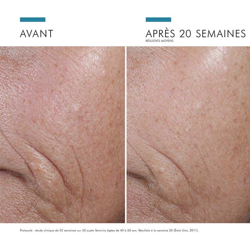 SkinCeuticals C E Ferulic, before and after photos of the cheek
