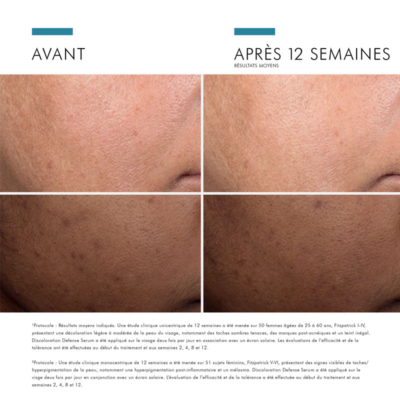 SkinCeuticals Discoloration Defense, before and after photos of the cheek on two skin tones