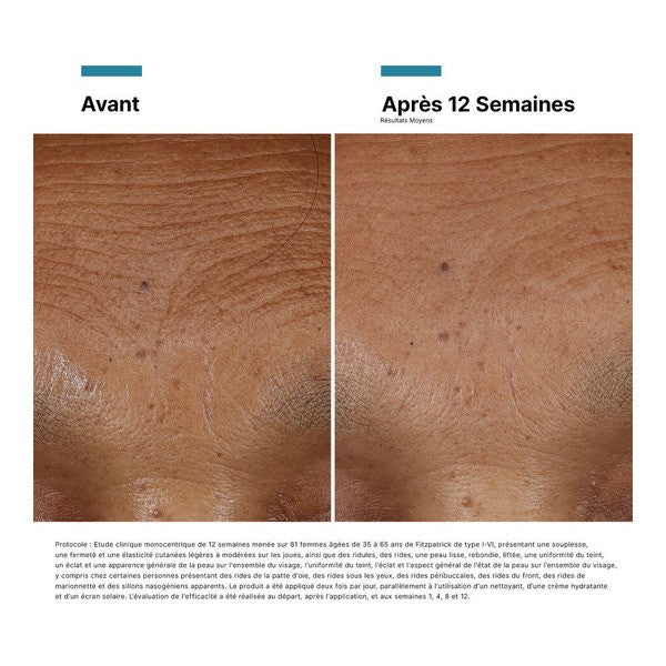SkinCeuticals HA Intensifier Multi-Glycan, before and after photos of the forehead