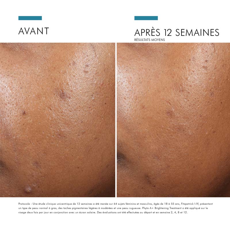 SkinCeuticals Phyto A+, before and after photos of the cheek