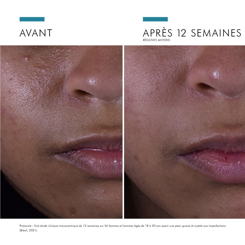 SkinCeuticals Silymarin CF, before and after photos of the cheek