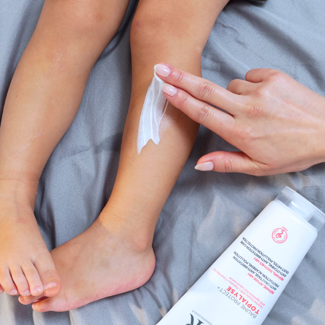 SVR Topialyse, hand spreading balm on a shin beside the tube
