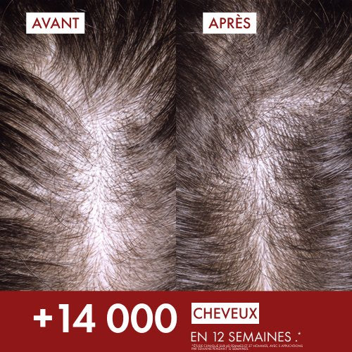 Vichy Dercos R.E.G.E.N. Booster, before and after photos of the scalp, text in French
