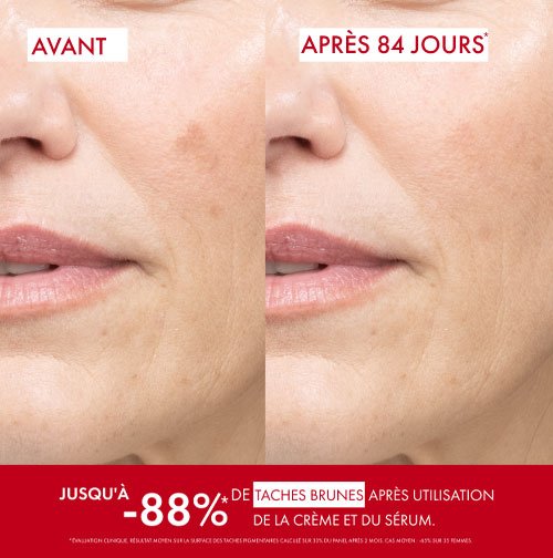Vichy Liftactiv B3, before and after photos of the cheek