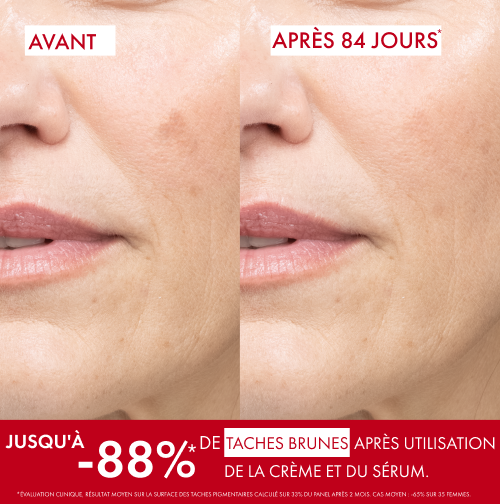 Vichy Liftactiv Specialist B3, before and after photos of the cheek