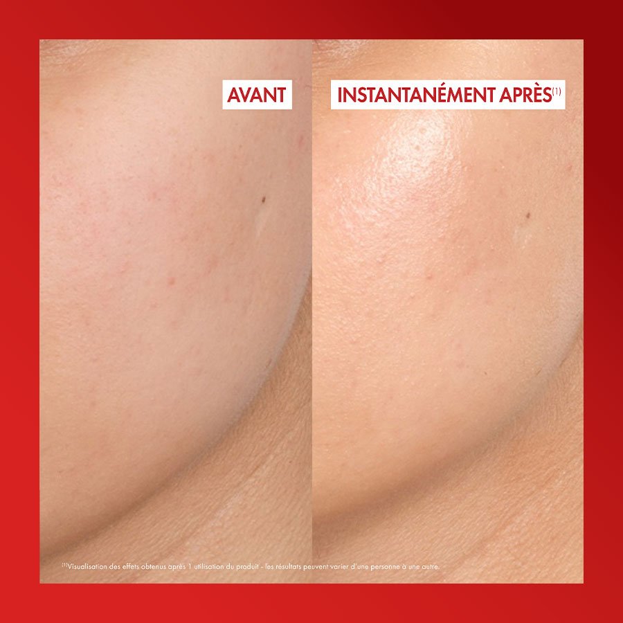 Vichy Liftactiv Collagen Specialist, before and after close-ups of the skin