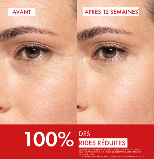Vichy Liftactiv Collagen Specialist, before and after photos of the eye area