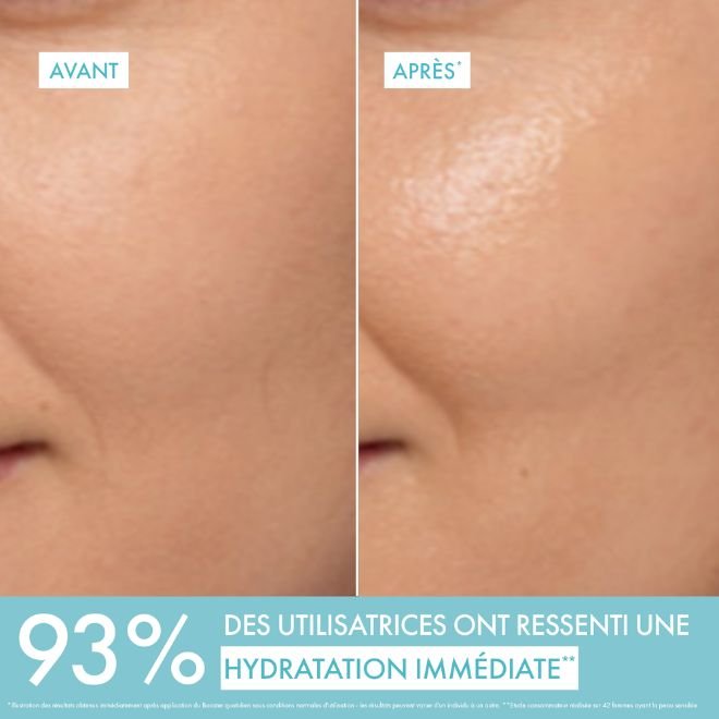 Vichy Mineral 89, before and after close-ups of the skin